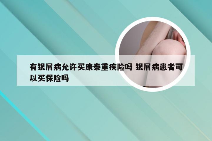 有银屑病允许买康泰重疾险吗 银屑病患者可以买保险吗