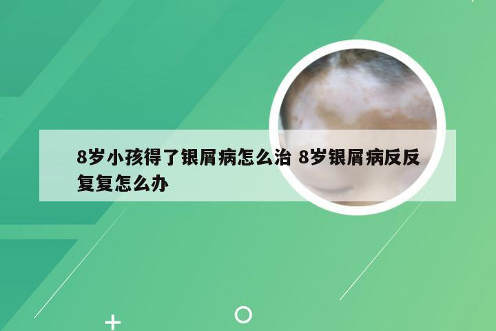 8岁小孩得了银屑病怎么治 8岁银屑病反反复复怎么办