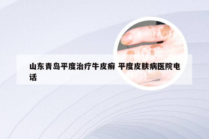 山东青岛平度治疗牛皮癣 平度皮肤病医院电话