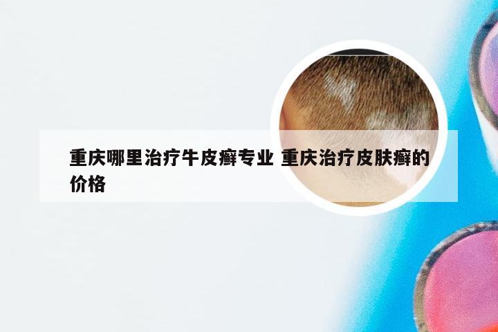 重庆哪里治疗牛皮癣专业 重庆治疗皮肤癣的价格