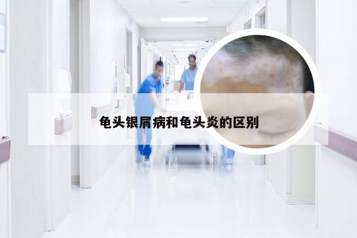 龟头银屑病和龟头炎的区别