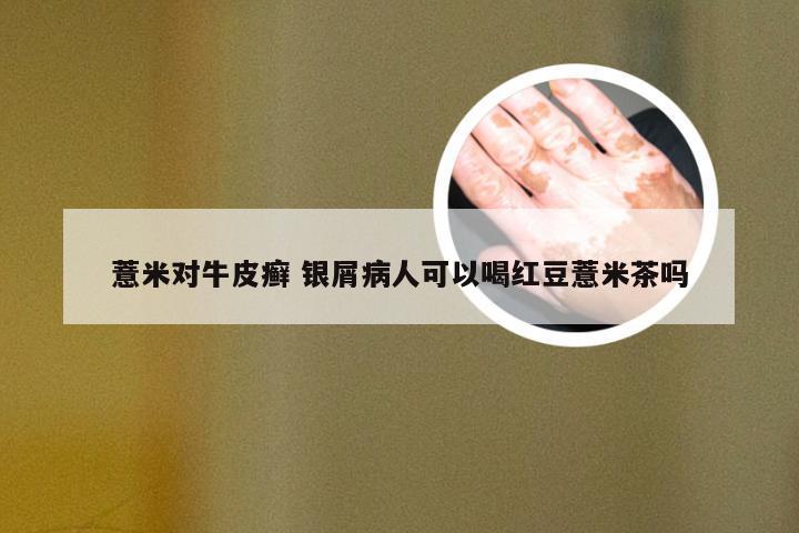 薏米对牛皮癣 银屑病人可以喝红豆薏米茶吗