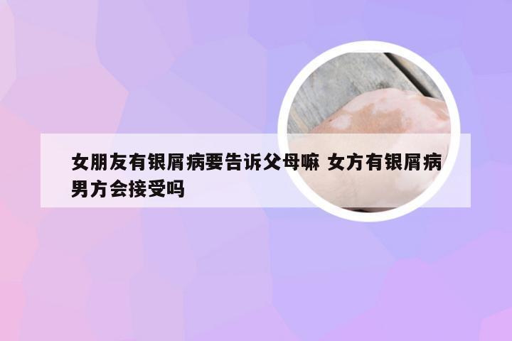 女朋友有银屑病要告诉父母嘛 女方有银屑病男方会接受吗