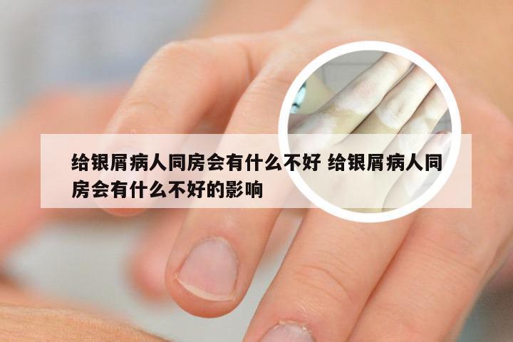 给银屑病人同房会有什么不好 给银屑病人同房会有什么不好的影响