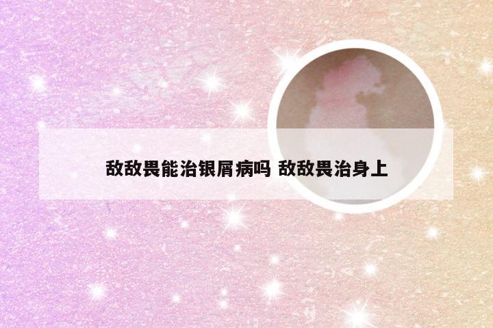 敌敌畏能治银屑病吗 敌敌畏治身上