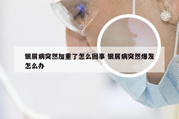 银屑病突然加重了怎么回事 银屑病突然爆发怎么办
