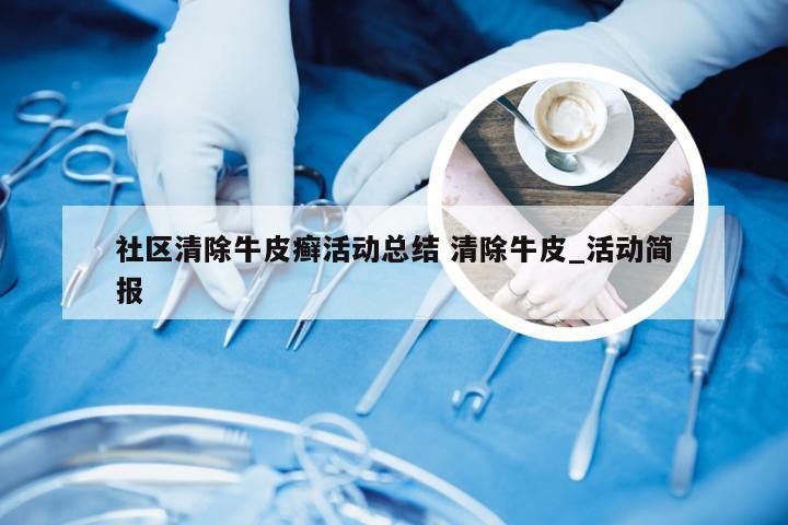 社区清除牛皮癣活动总结 清除牛皮_活动简报