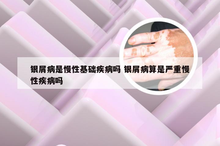 银屑病是慢性基础疾病吗 银屑病算是严重慢性疾病吗