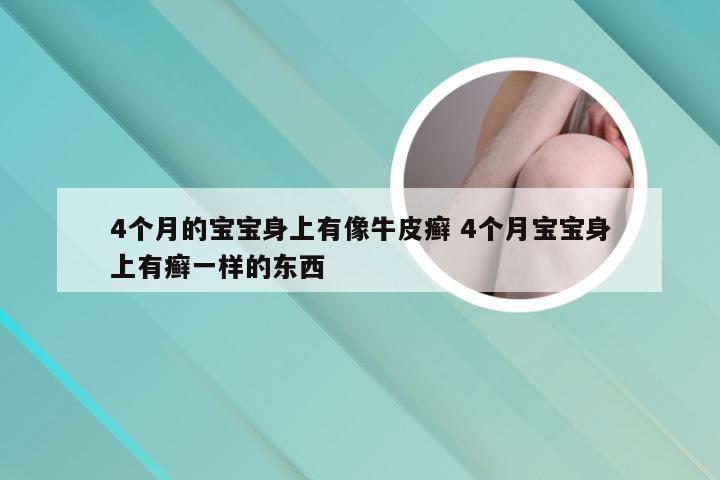 4个月的宝宝身上有像牛皮癣 4个月宝宝身上有癣一样的东西