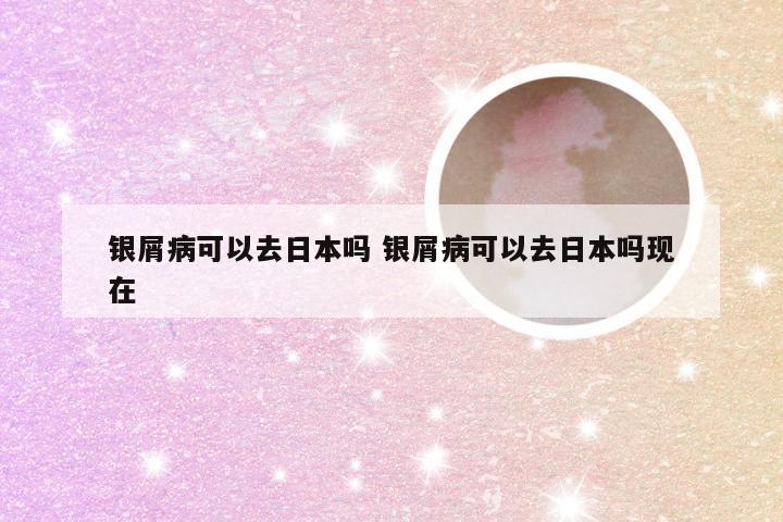银屑病可以去日本吗 银屑病可以去日本吗现在