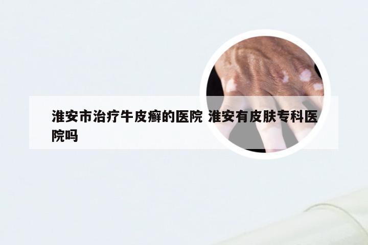 淮安市治疗牛皮癣的医院 淮安有皮肤专科医院吗