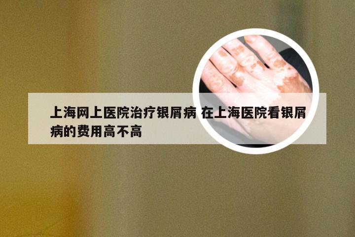 上海网上医院治疗银屑病 在上海医院看银屑病的费用高不高