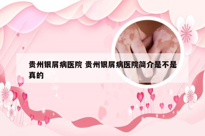 贵州银屑病医院 贵州银屑病医院简介是不是真的