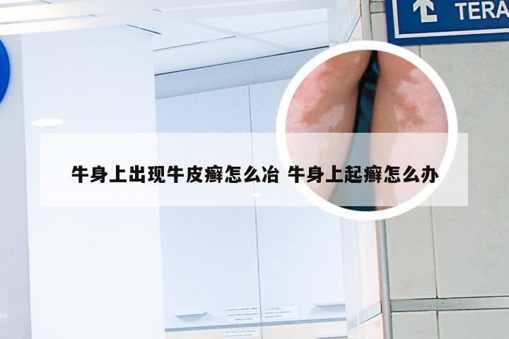 牛身上出现牛皮癣怎么冶 牛身上起癣怎么办
