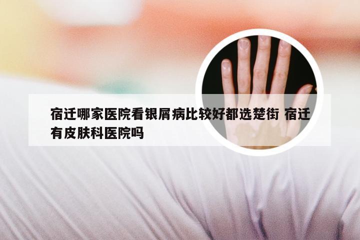 宿迁哪家医院看银屑病比较好都选楚街 宿迁有皮肤科医院吗