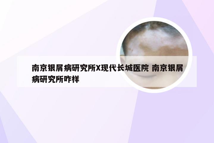 南京银屑病研究所X现代长城医院 南京银屑病研究所咋样