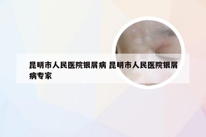 昆明市人民医院银屑病 昆明市人民医院银屑病专家