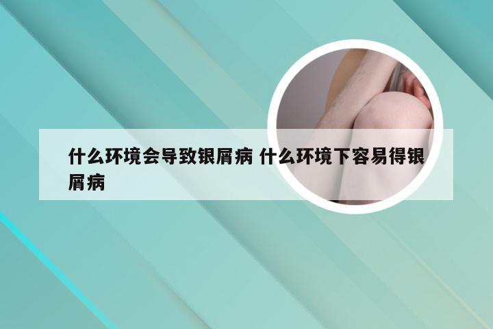 什么环境会导致银屑病 什么环境下容易得银屑病