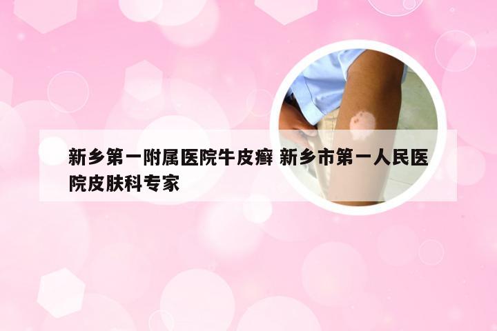 新乡第一附属医院牛皮癣 新乡市第一人民医院皮肤科专家