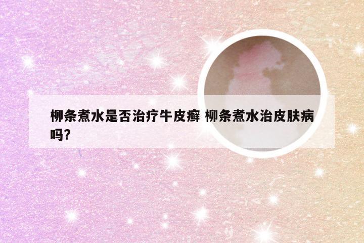 柳条煮水是否治疗牛皮癣 柳条煮水治皮肤病吗?