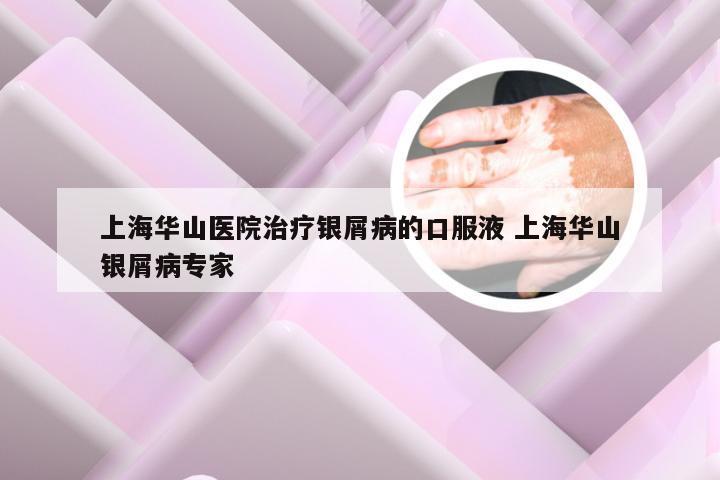 上海华山医院治疗银屑病的口服液 上海华山银屑病专家