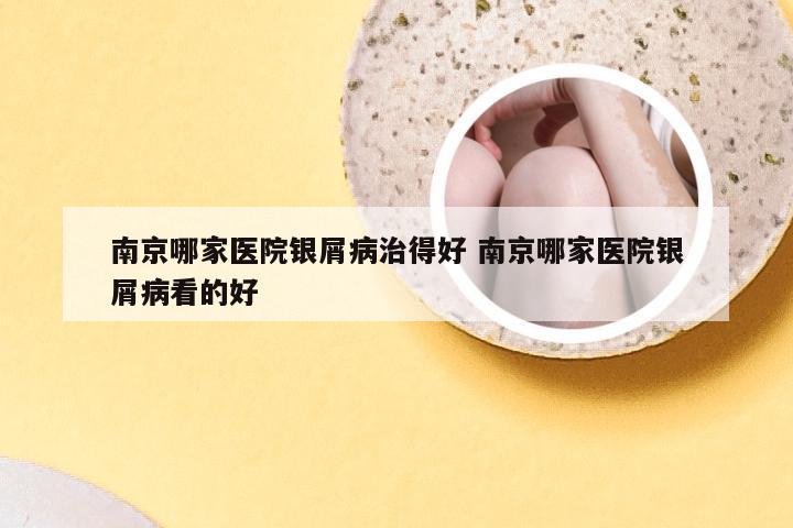 南京哪家医院银屑病治得好 南京哪家医院银屑病看的好