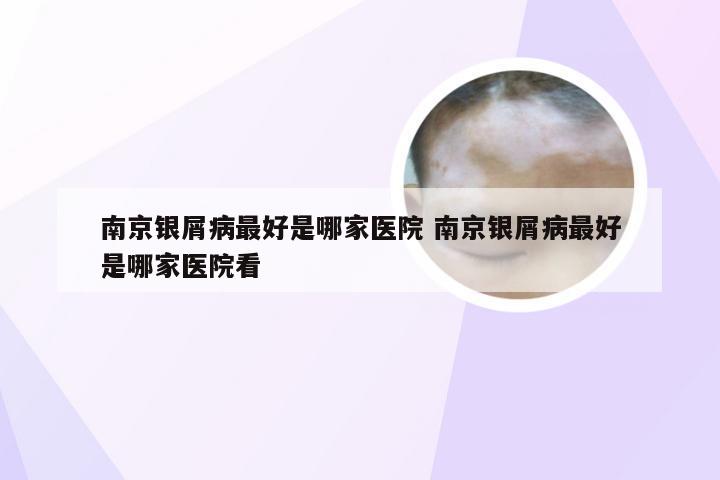 南京银屑病最好是哪家医院 南京银屑病最好是哪家医院看