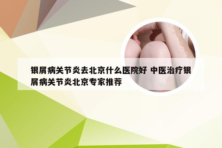 银屑病关节炎去北京什么医院好 中医治疗银屑病关节炎北京专家推荐