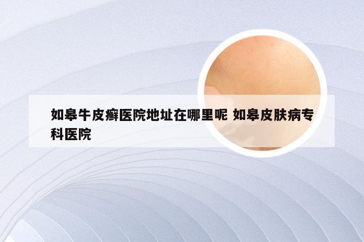 如皋牛皮癣医院地址在哪里呢 如皋皮肤病专科医院