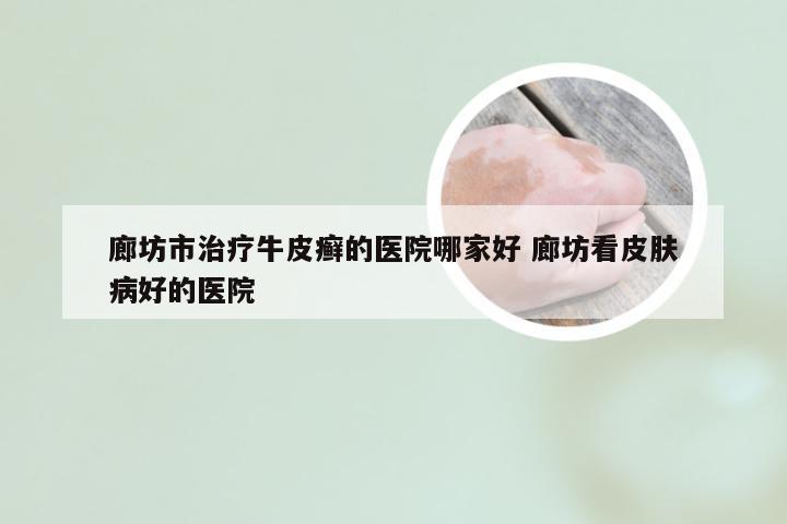 廊坊市治疗牛皮癣的医院哪家好 廊坊看皮肤病好的医院