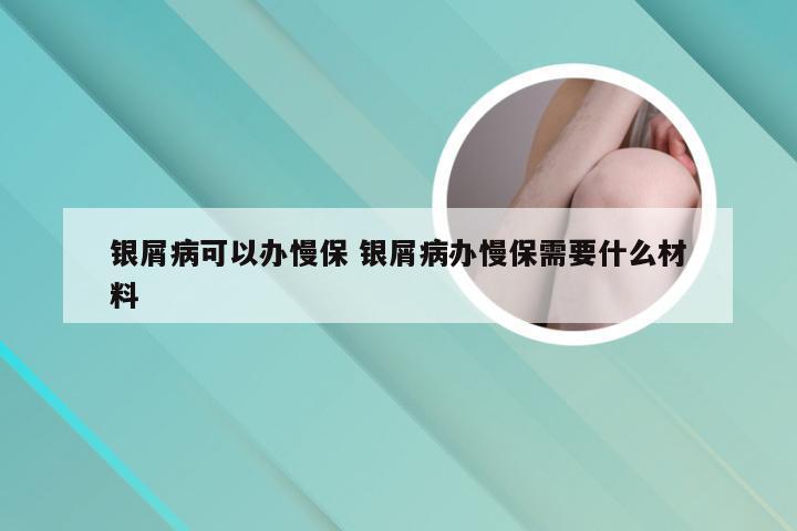 银屑病可以办慢保 银屑病办慢保需要什么材料