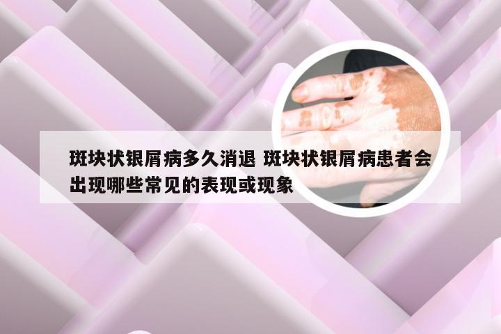 斑块状银屑病多久消退 斑块状银屑病患者会出现哪些常见的表现或现象