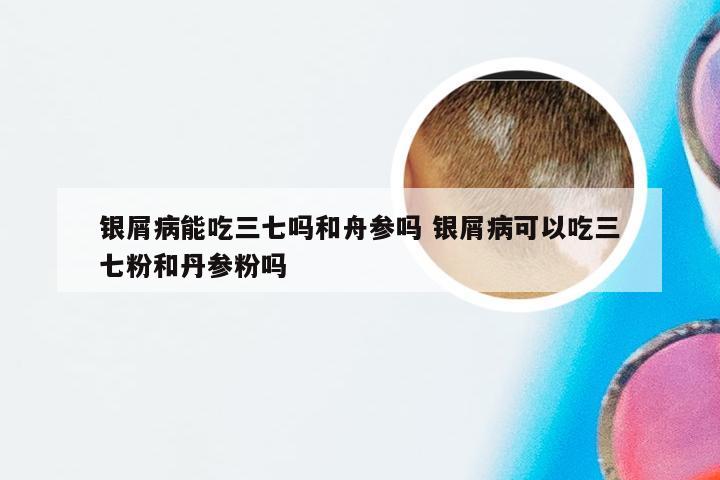 银屑病能吃三七吗和舟参吗 银屑病可以吃三七粉和丹参粉吗