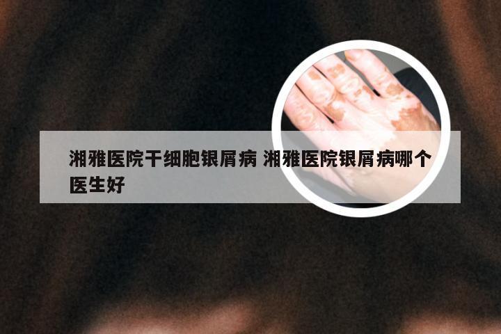 湘雅医院干细胞银屑病 湘雅医院银屑病哪个医生好