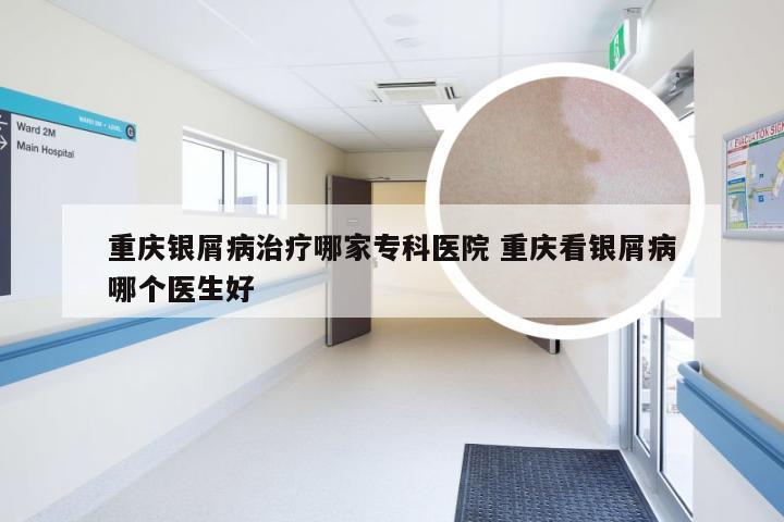 重庆银屑病治疗哪家专科医院 重庆看银屑病哪个医生好