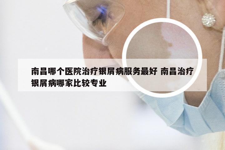 南昌哪个医院治疗银屑病服务最好 南昌治疗银屑病哪家比较专业
