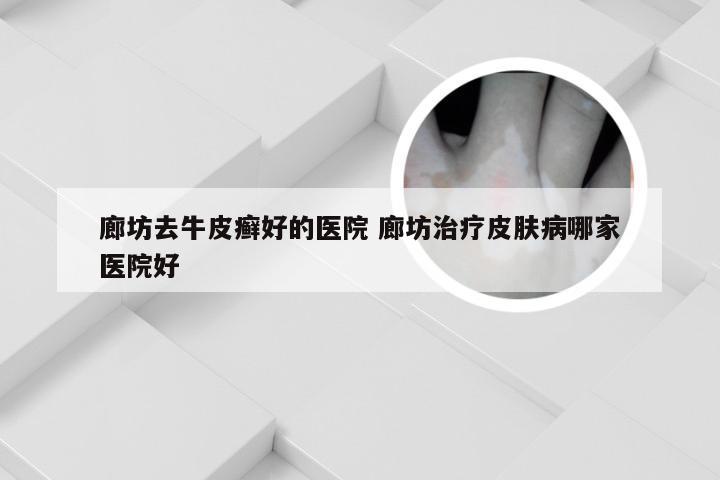 廊坊去牛皮癣好的医院 廊坊治疗皮肤病哪家医院好