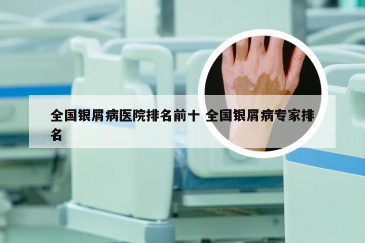 全国银屑病医院排名前十 全国银屑病专家排名