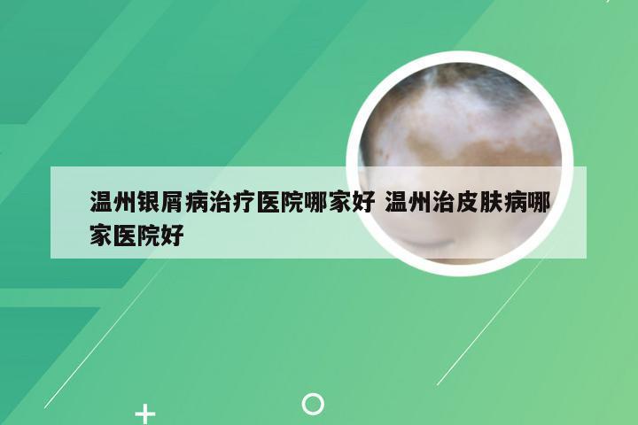 温州银屑病治疗医院哪家好 温州治皮肤病哪家医院好