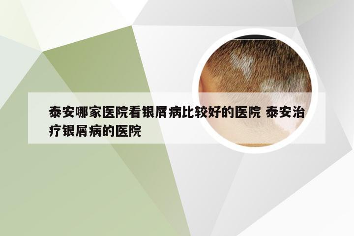 泰安哪家医院看银屑病比较好的医院 泰安治疗银屑病的医院