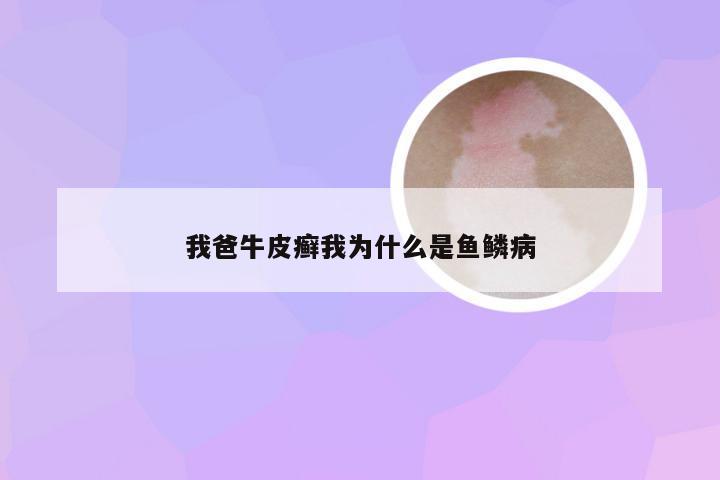 我爸牛皮癣我为什么是鱼鳞病
