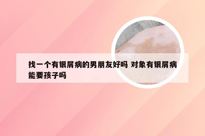 找一个有银屑病的男朋友好吗 对象有银屑病能要孩子吗