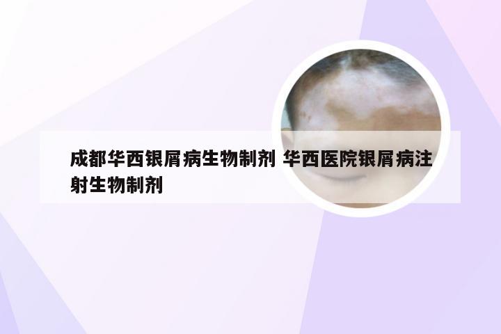 成都华西银屑病生物制剂 华西医院银屑病注射生物制剂