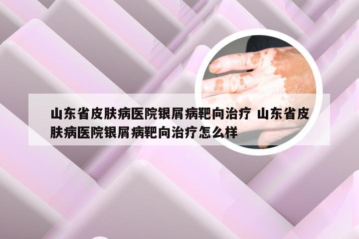 山东省皮肤病医院银屑病靶向治疗 山东省皮肤病医院银屑病靶向治疗怎么样
