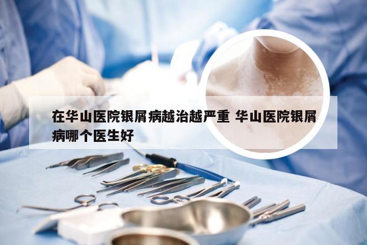 在华山医院银屑病越治越严重 华山医院银屑病哪个医生好