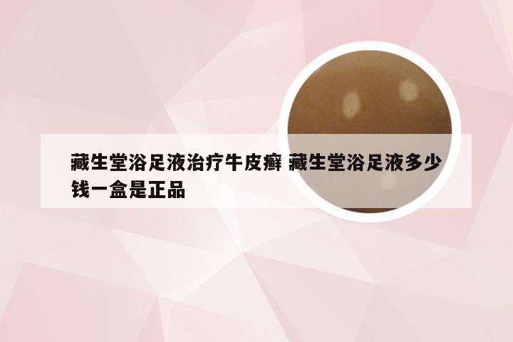 藏生堂浴足液治疗牛皮癣 藏生堂浴足液多少钱一盒是正品