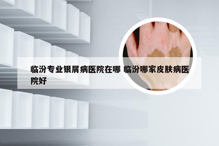 临汾专业银屑病医院在哪 临汾哪家皮肤病医院好