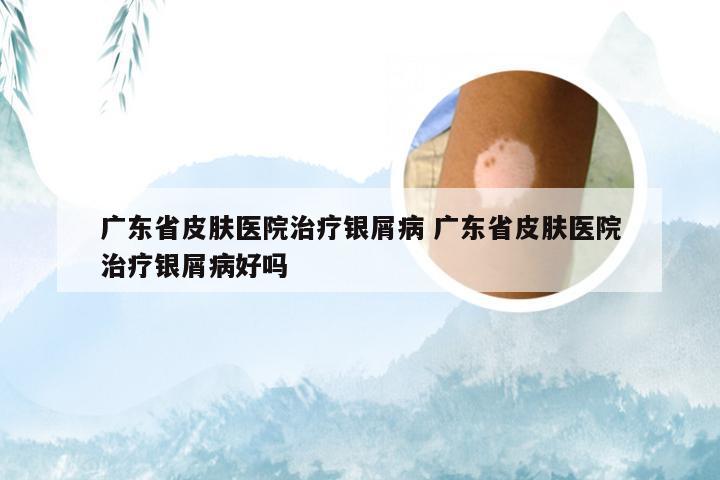 广东省皮肤医院治疗银屑病 广东省皮肤医院治疗银屑病好吗