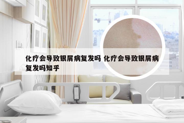 化疗会导致银屑病复发吗 化疗会导致银屑病复发吗知乎