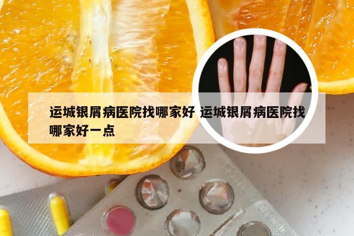 运城银屑病医院找哪家好 运城银屑病医院找哪家好一点